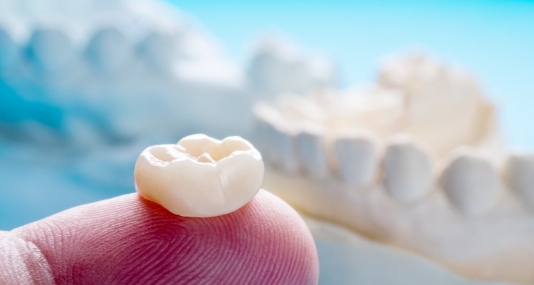 Close up of person holding dental crown in Grapevine on their finger