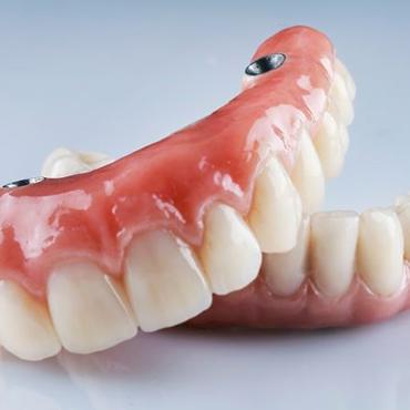 Close-up of removable implant dentures