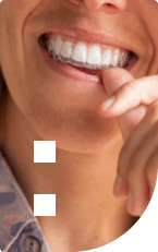 Close up of person putting Invisalign clear aligner over their teeth