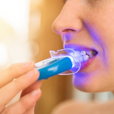 Person using take home teeth whitening kit