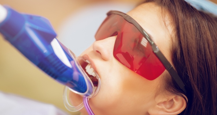 Young woman with tray over her teeth for fluoride treatment