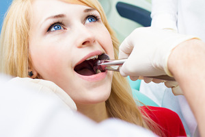 Blonde female dental patient having a tooth extracted